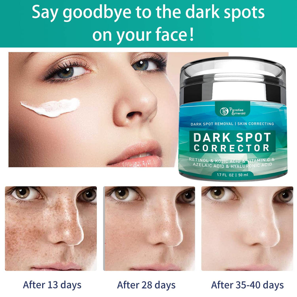 Paradise Emerald Dark Spot Remover application demonstrates simple at-home skincare for targeted spot care.