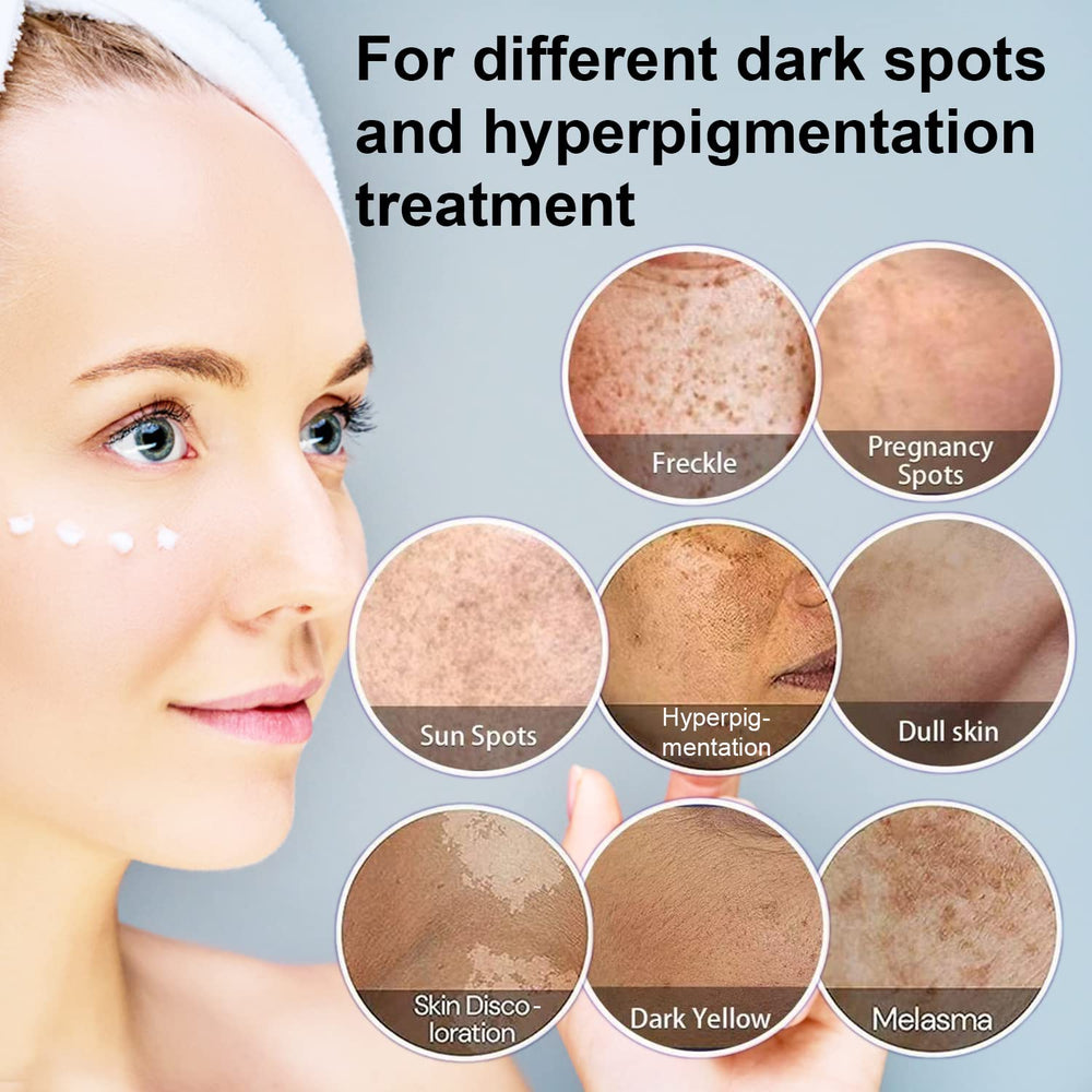 Paradise Emerald Dark Spot Remover ingredients panel suggests gentle formulas suitable for all skin types.
