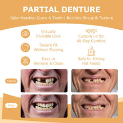BPA-free durable materials used in partial dentures