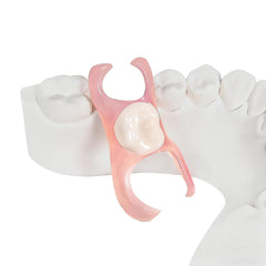 Custom partial dentures designed to fit a single missing tooth with natural color match