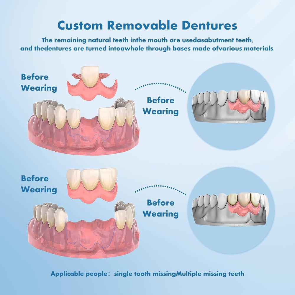 Comfortable, molded-fit partial denture shown during eating