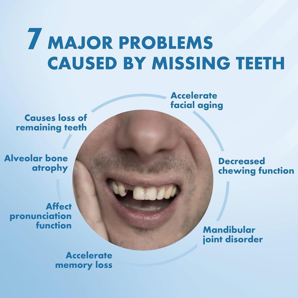 Tooth-colored denture material matched to natural teeth