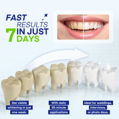Close-up of Pearl Smile whitening gel