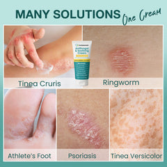 PHARMBANNER antifungal cream with tea tree oil ingredient for calming relief.