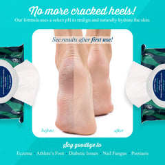 pHeet Foot Wipes on the go pack for portable foot care
