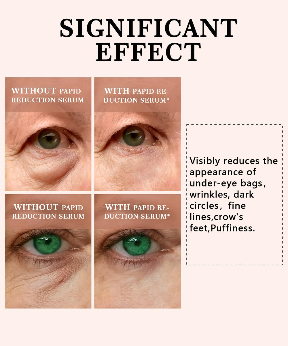 Phydrulis instant eye serum swatch highlighting quick depuffing benefits