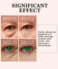 Phydrulis instant eye serum swatch highlighting quick depuffing benefits