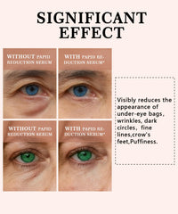 Phydrulis perfection firming lift cream being applied for refreshed eyes