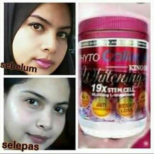 Ingredients and benefits of Phyto Collagen Whitening 19X Stem Cell