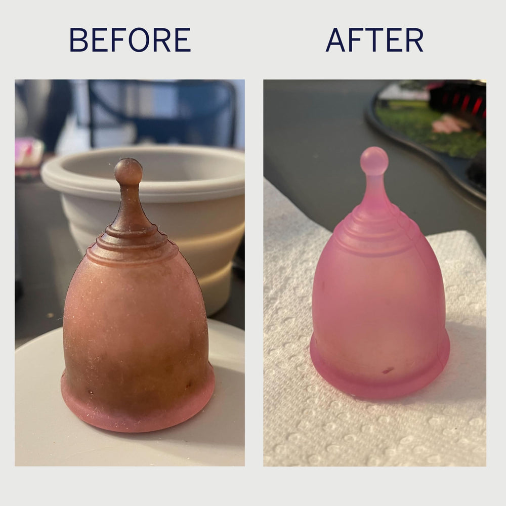 Disc cleaning with Pixie Cup stain remover saves time and effort.