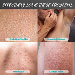 Back and chest area after exfoliation with POP MODERN.C product.