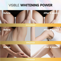 PRFTMK Skin Bleaching Cream knees supports uniform complexion with lightweight feel.