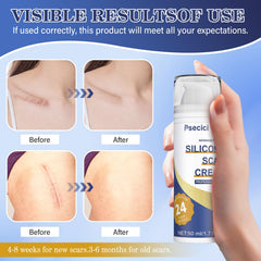 Psecici scar gel being massaged on skin, boosts evenness and moisture.