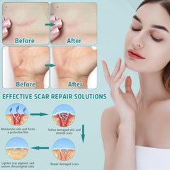 Pumkot scar cream moisturizes skin to support healing and even tone