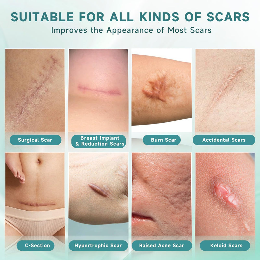 Pumkot scar cream texture closeup reveals lightweight, non-greasy feel