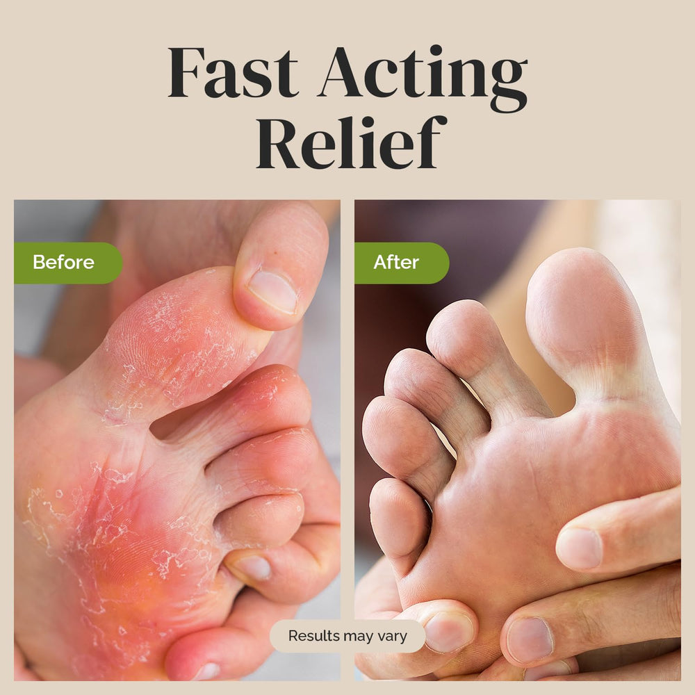 Puriya antifungal cream texture swirl shows smooth, moisturizing ointment for dry skin.