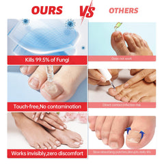 QQE Nail Fungus Treatment nails close-up reveals improved appearance with regular use.