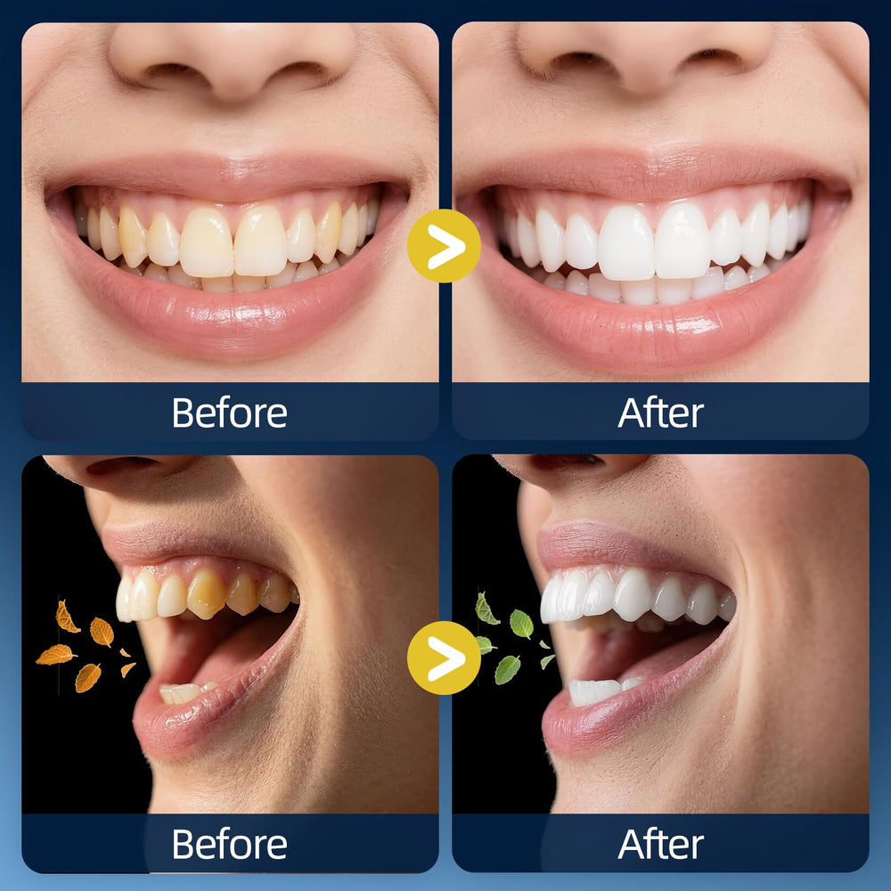 Fluoride-free mouthwash for sensitive gums