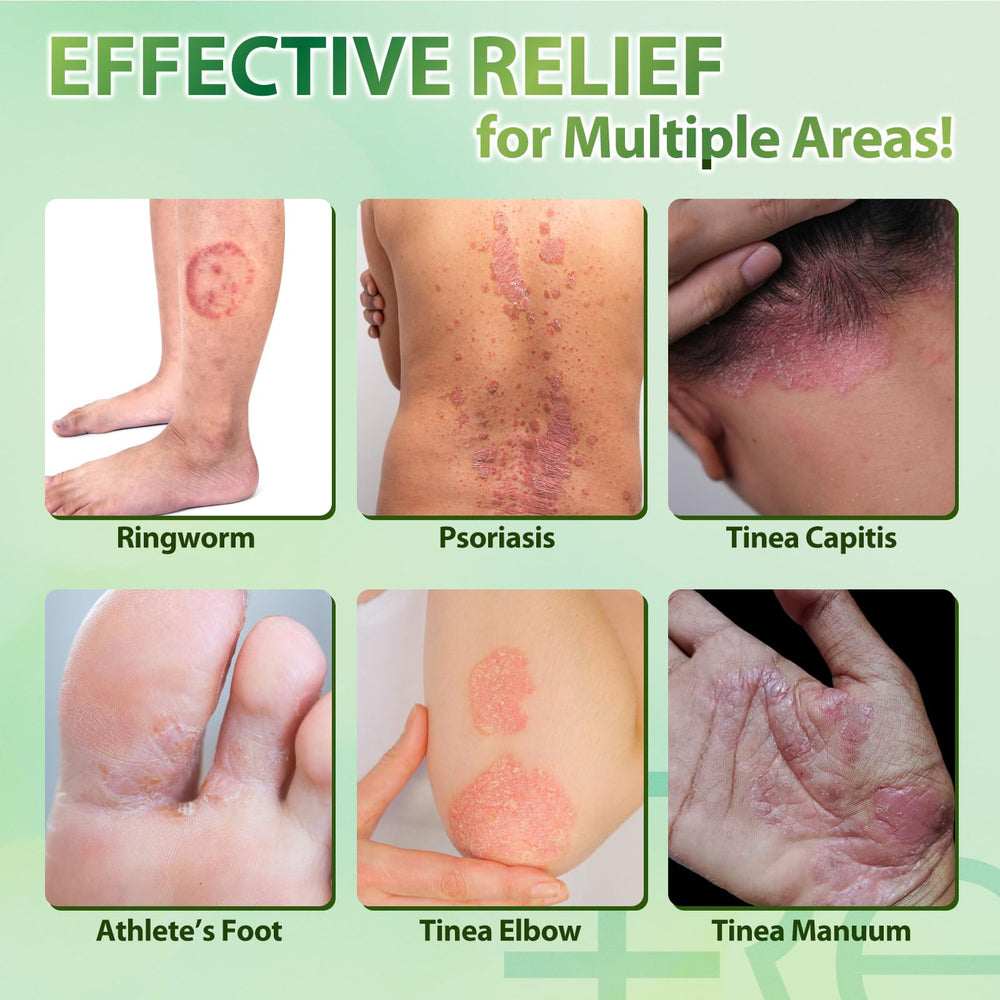 Recuren Plus Compact 20g tube ideal for travel.