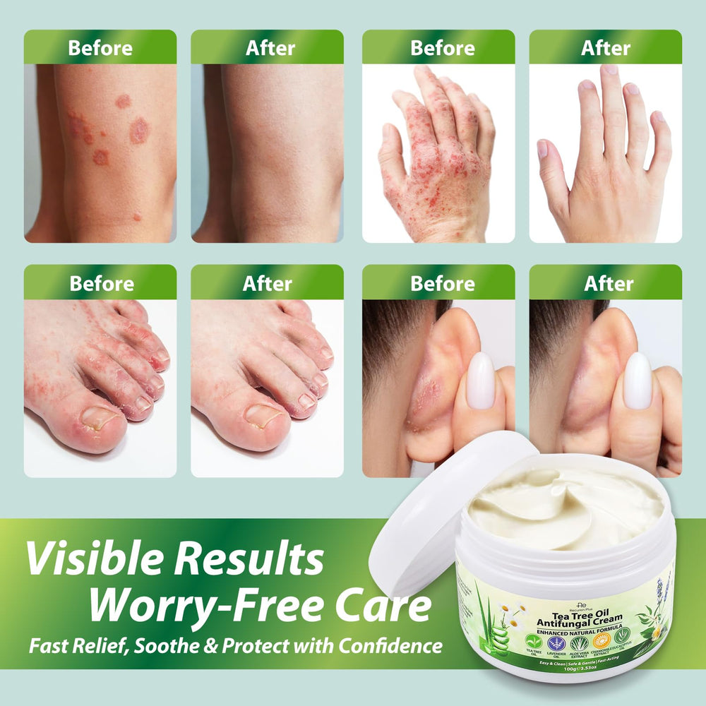 Recuren Plus-skin-barrier-protection emphasizes non-greasy hydration and protective feel.
