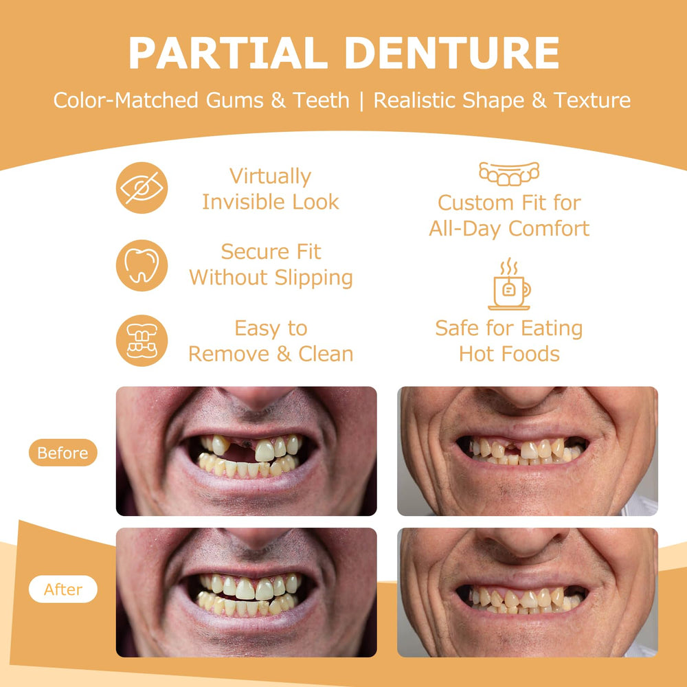 Removable dentures for easy cleaning