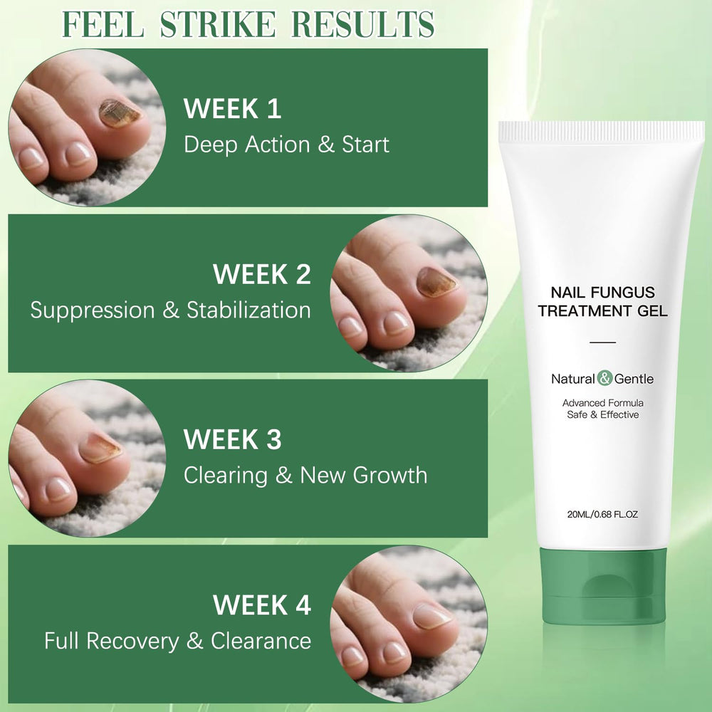 Retigazo Nail Repair Gel nails-after suggests smoother, healthier-looking nails with regular use