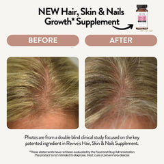 Close-up of Biotin patent form in Revive supplement