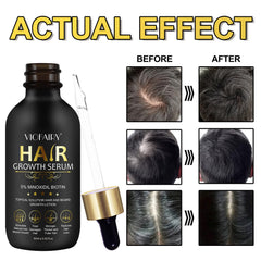 RHBESTOK Biotin serum bottle promotes healthier follicles and hair resilience.