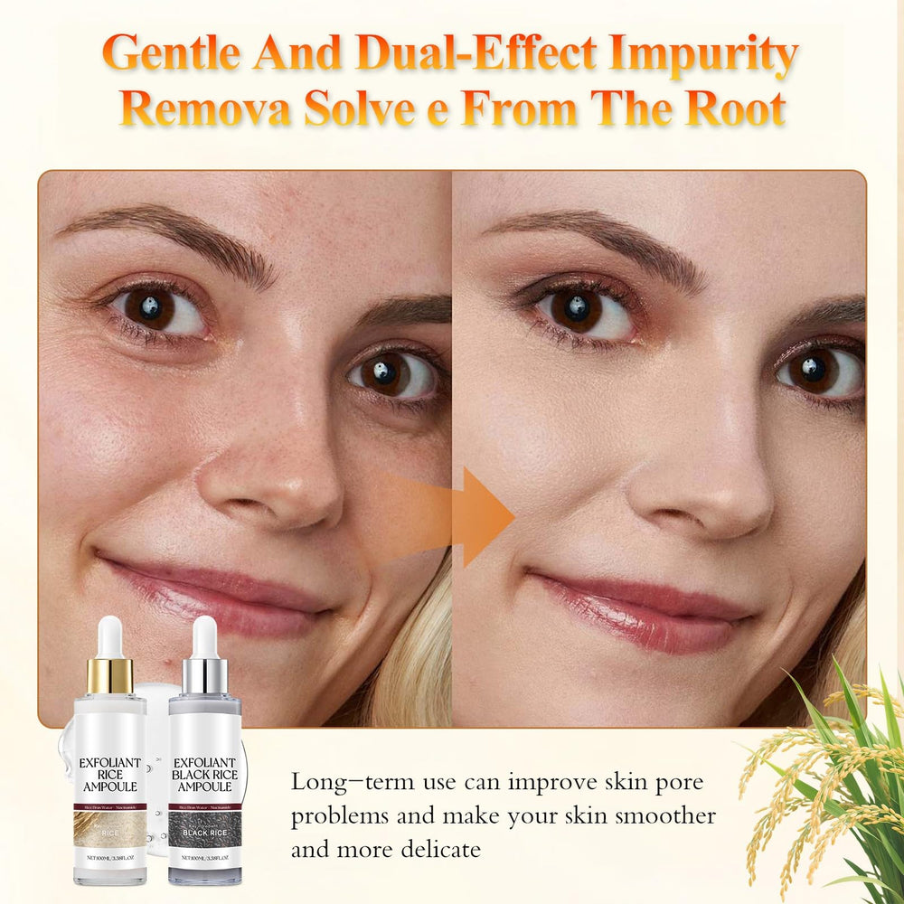 Black and White Rice Peeling with rice enzyme face for pore refinement.