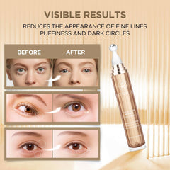 RONKIE Eye Cream retinol-collagen-hyaluronic close-up emphasizes hydration
