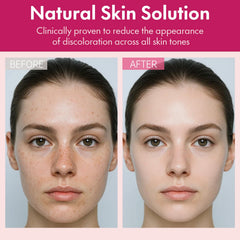 Roseblem eye-area discoloration targeting visual for even tone around delicate areas