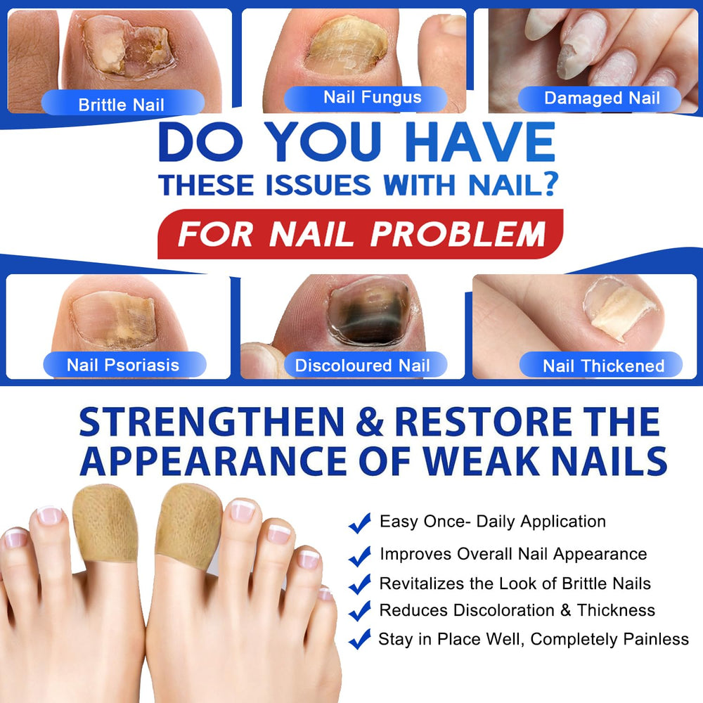 Hypoallergenic adhesive on Ruicen patch adheres to the nail