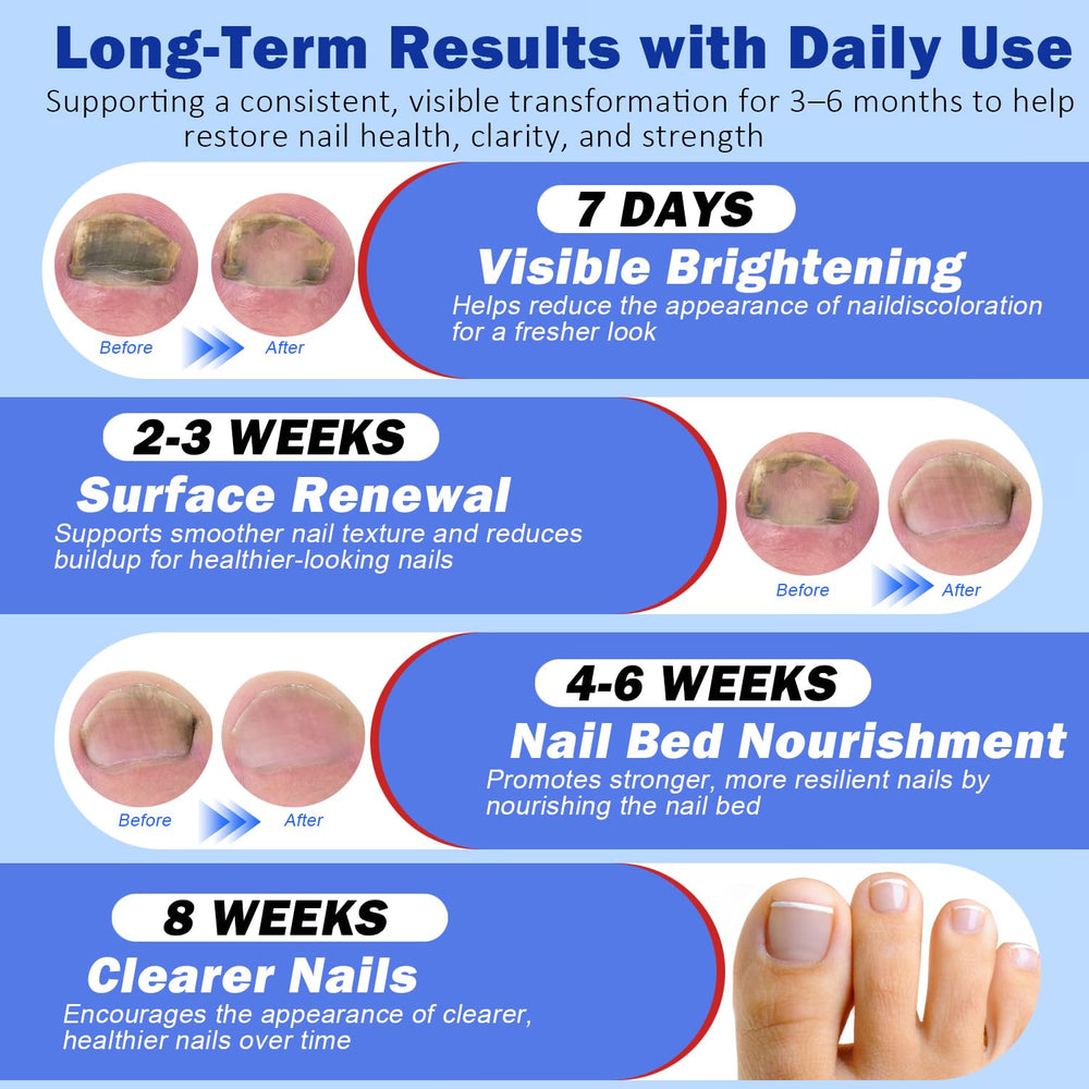 Breathable material of Ruicen patch supports skin comfort