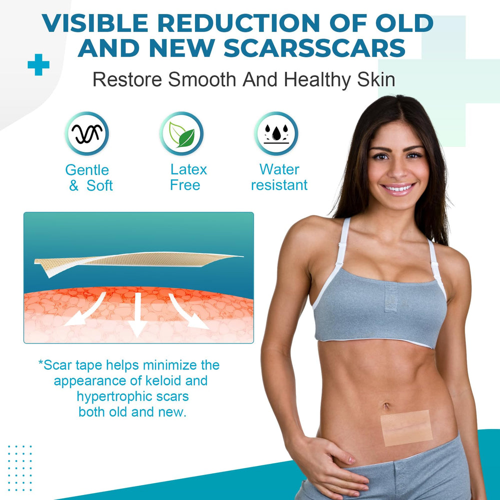 Rvlaim scar tape easy-cut-edges tearable design for quick sizing