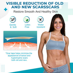 Rvlaim scar tape easy-cut-edges tearable design for quick sizing