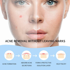 Safirst Star 200-count colorful pack provides versatile blemish coverage.