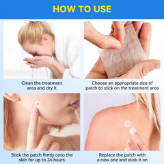 SAKIMA Wart Remover Patches 144 patches kit for flexible scheduling