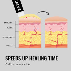 SandBar Callus Salve applied after filing for smoother, cared-for skin