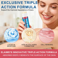 Scar Butter nourishes dry skin to improve moisture and suppleness.