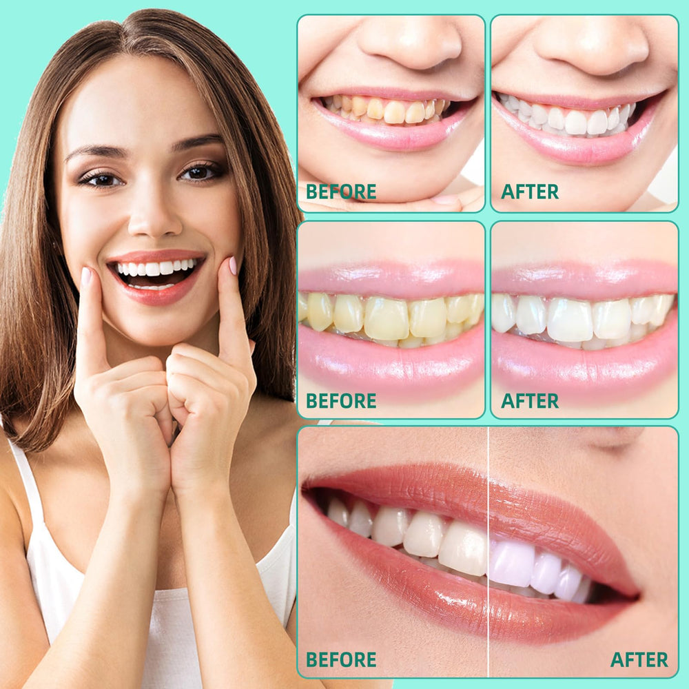 Sefudun Coconut Pulling Oil promotes whitening and healthier gums