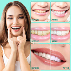 Sefudun Coconut Pulling Oil promotes whitening and healthier gums