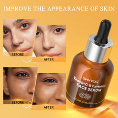 SHVYOG Vitamin C Turmeric Serum texture closeup emphasizes lightweight, non-greasy absorption