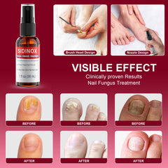 Sidinox five-pack packaging provides convenient nail care value.