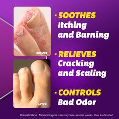 Silka foot-between-toes application demonstrating double-daily use.