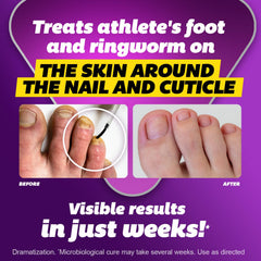 Close-up of Silka bottle with Tolnaftate 1% for toenail care.