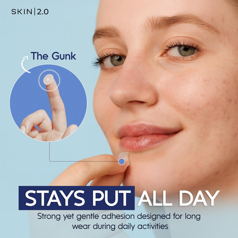 Skin 2.0 hydrocolloid patch absorbs oil and impurities on blemish.