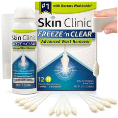 Skin Clinic Freeze 'n Clear kit with two applicator sizes for precise at-home wart treatment.