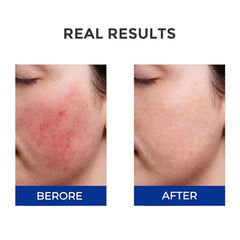 Licorice extract close-up signals soothing properties for redness support.