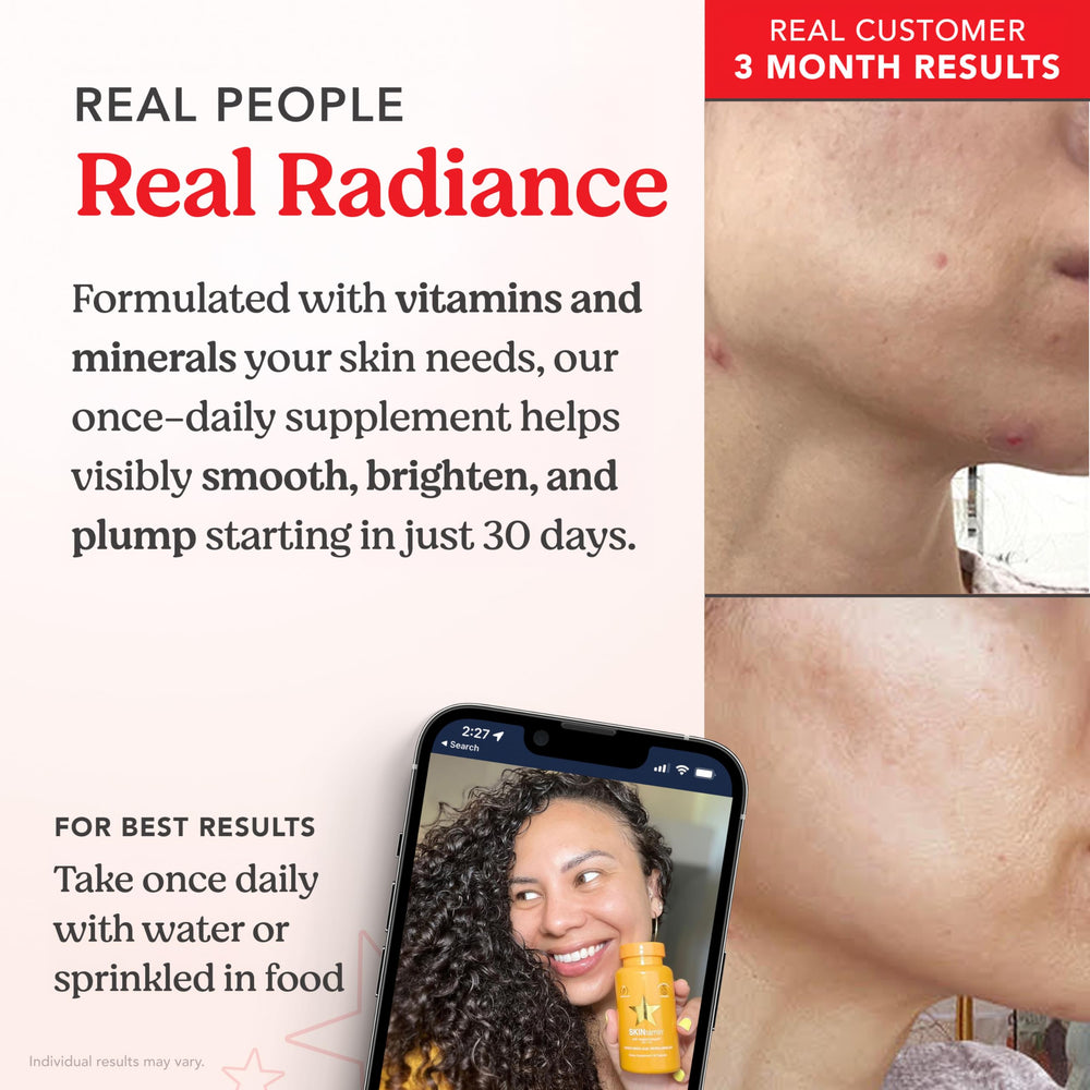 Before and after showing reduced blemishes with SKINtamin