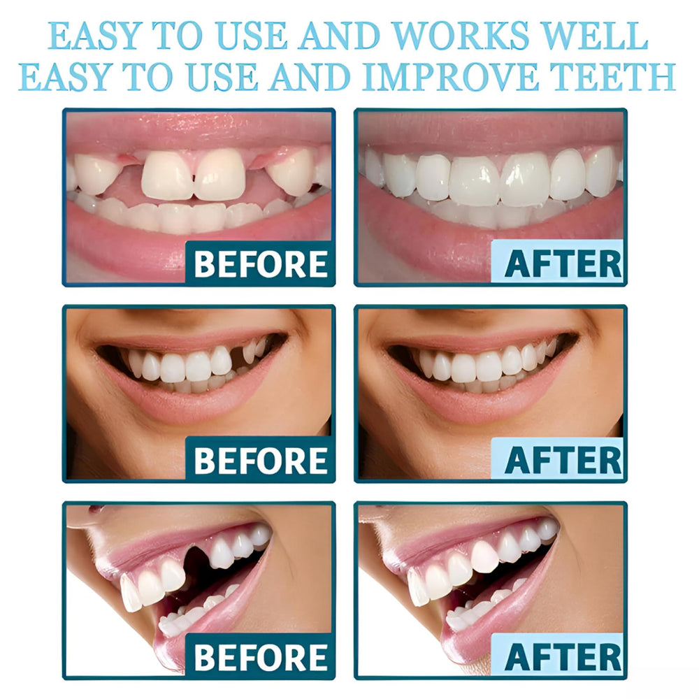 Smile set undergoing thermal customization in warm water